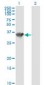 SCHAD / HADHSC Antibody (clone 4B5)